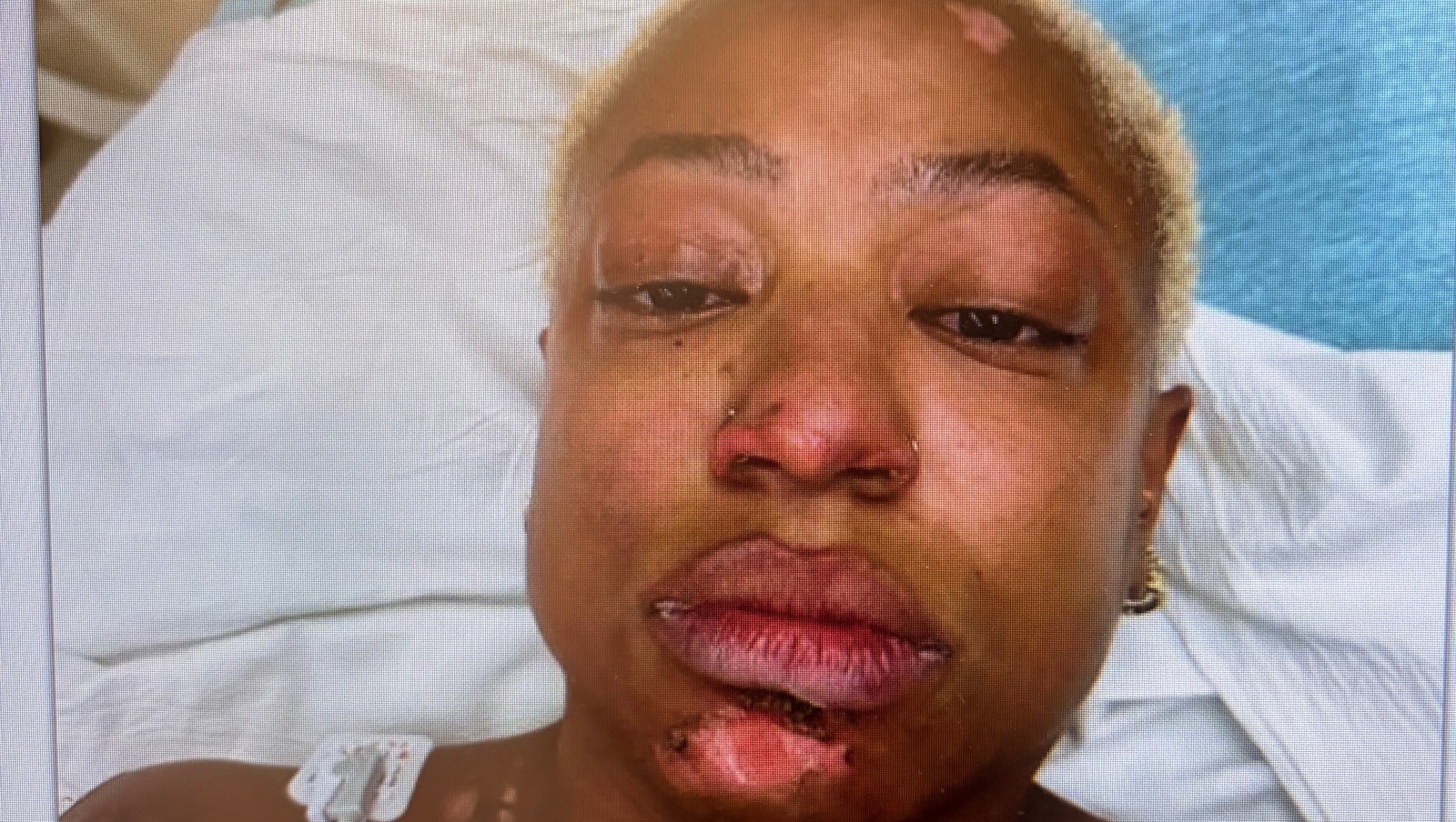 Support Talia’s Healing Journey After the Accident