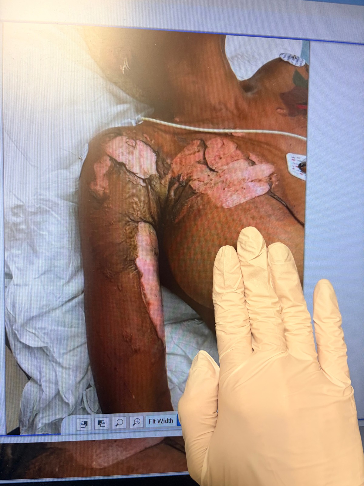 Support Talia’s Healing Journey After the Accident — photo 2