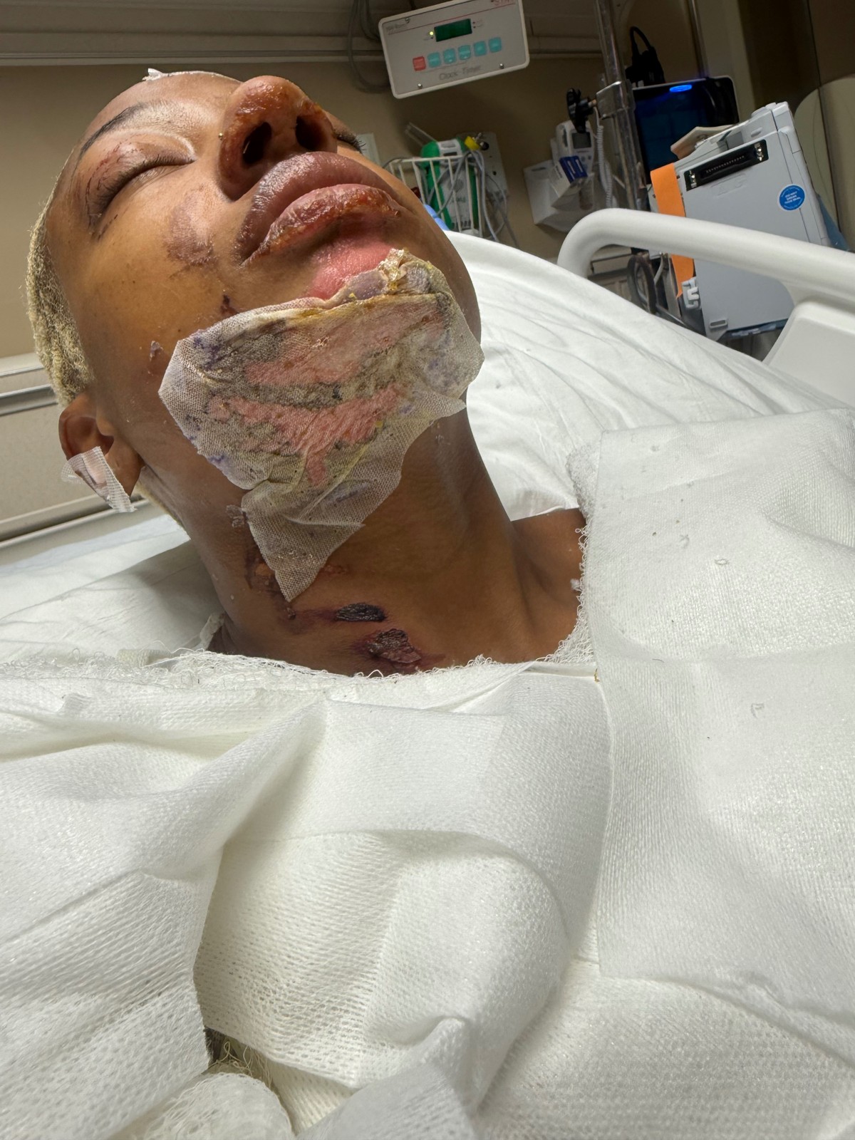 Support Talia’s Healing Journey After the Accident — photo 3