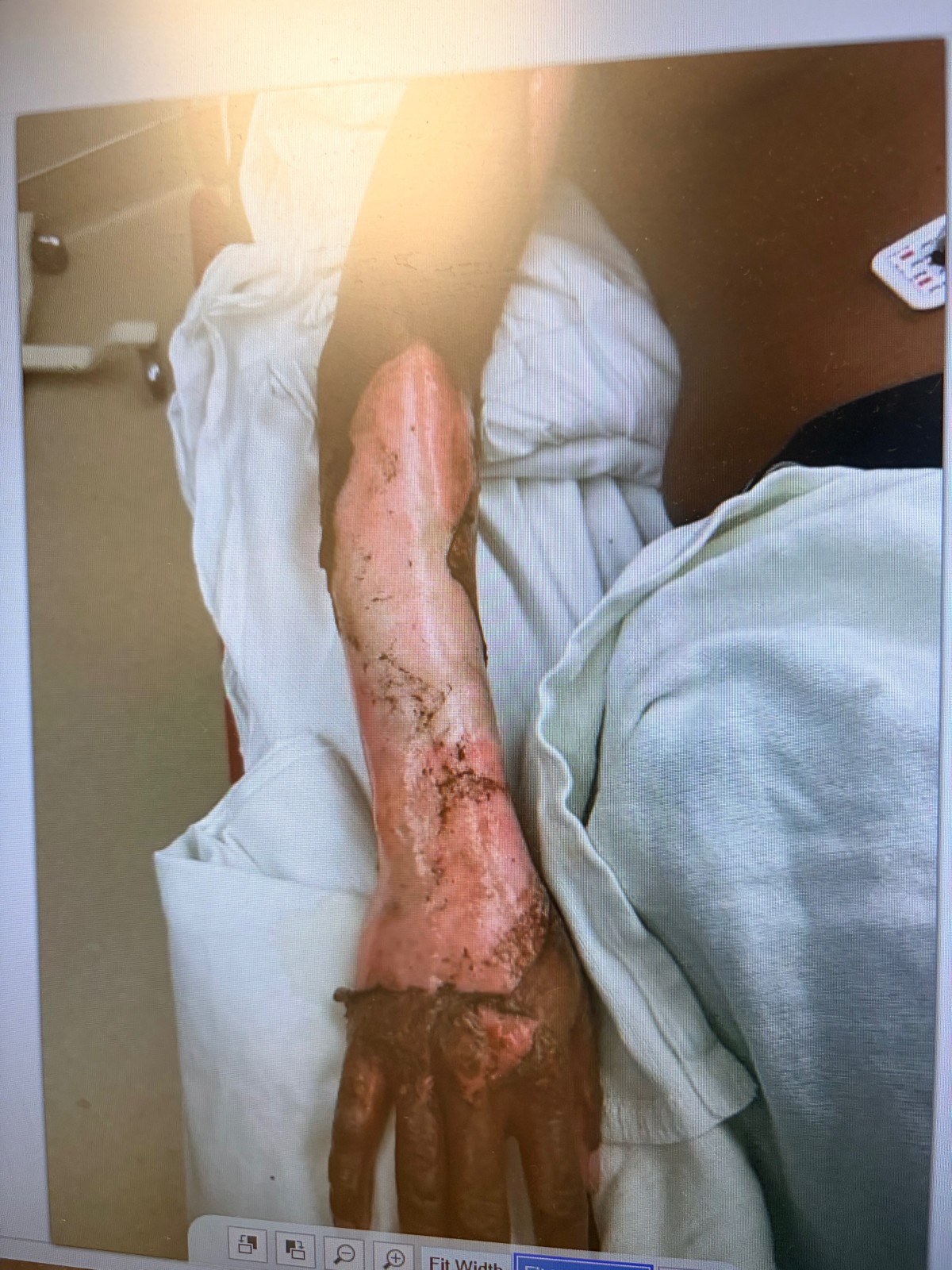 Support Talia’s Healing Journey After the Accident — photo 6
